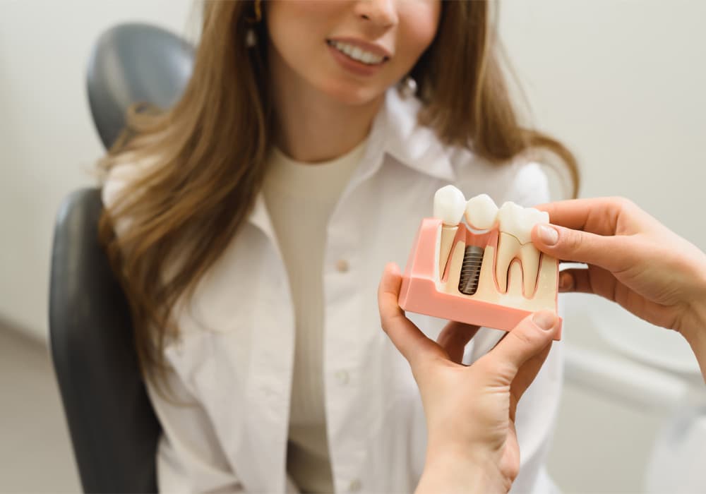 dental-implants